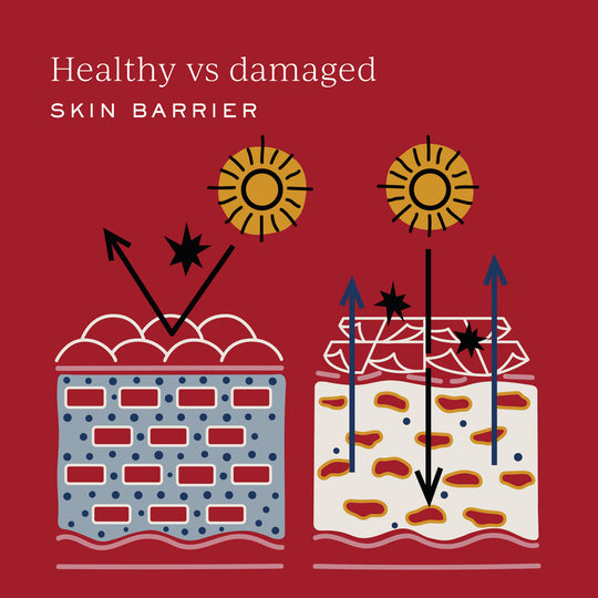 WHAT IS YOUR SKIN BARRIER?